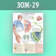 Плакат «Что такое болезнь Паркинсона?» (ЗОЖ-29, ламинир. бумага, А1, 1 лист)